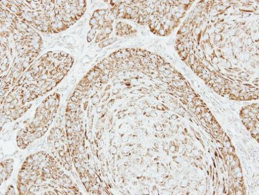 VDAC Antibody in Immunohistochemistry (Paraffin) (IHC (P))