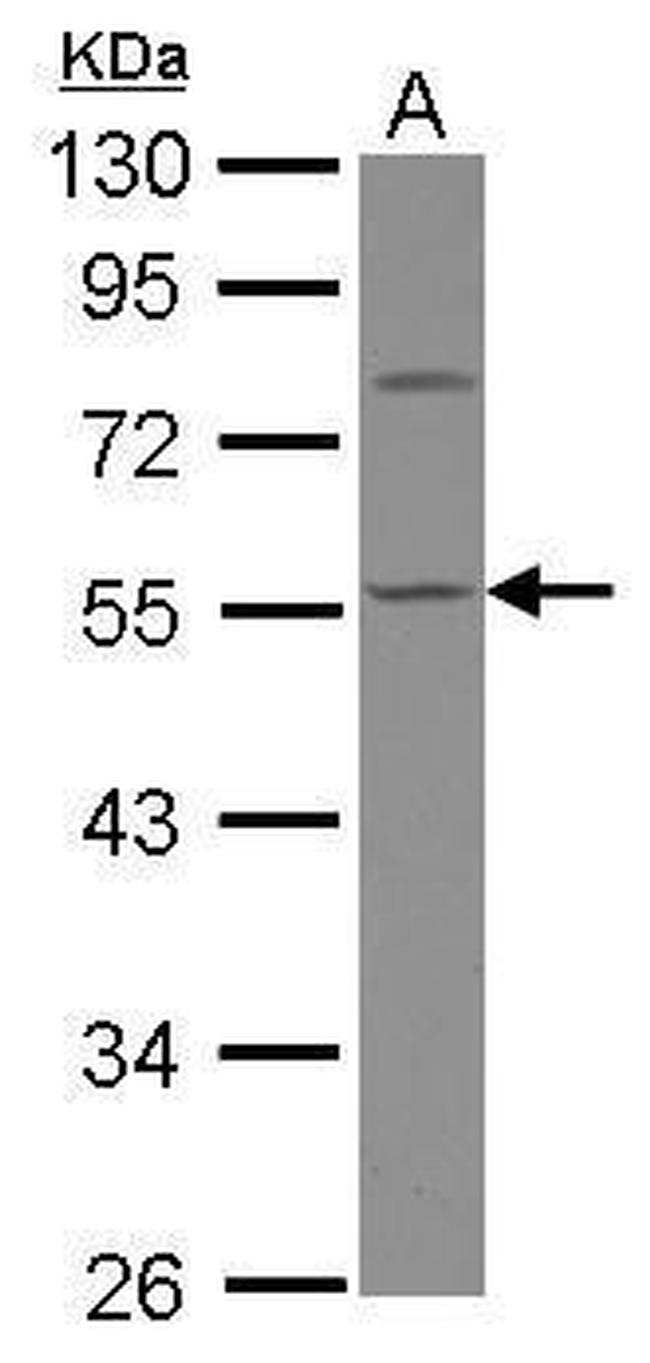 Calsequestrin Antibody in Western Blot (WB)