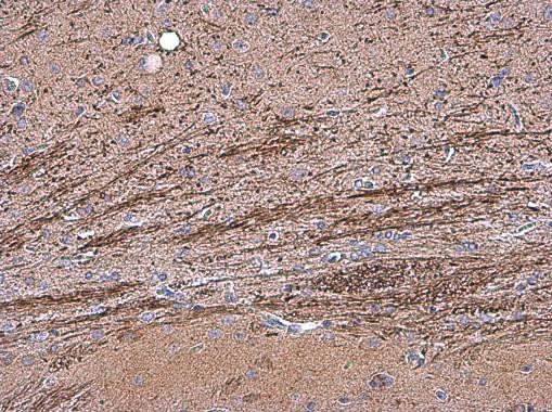 OMG Antibody in Immunohistochemistry (Paraffin) (IHC (P))