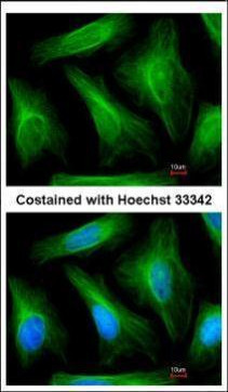 TUBA1A Antibody in Immunocytochemistry (ICC/IF)