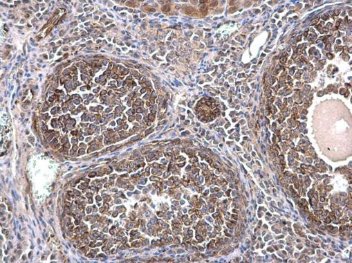 TUBA1A Antibody in Immunohistochemistry (Paraffin) (IHC (P))