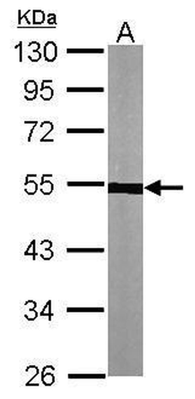 TUBA1A Antibody in Western Blot (WB)