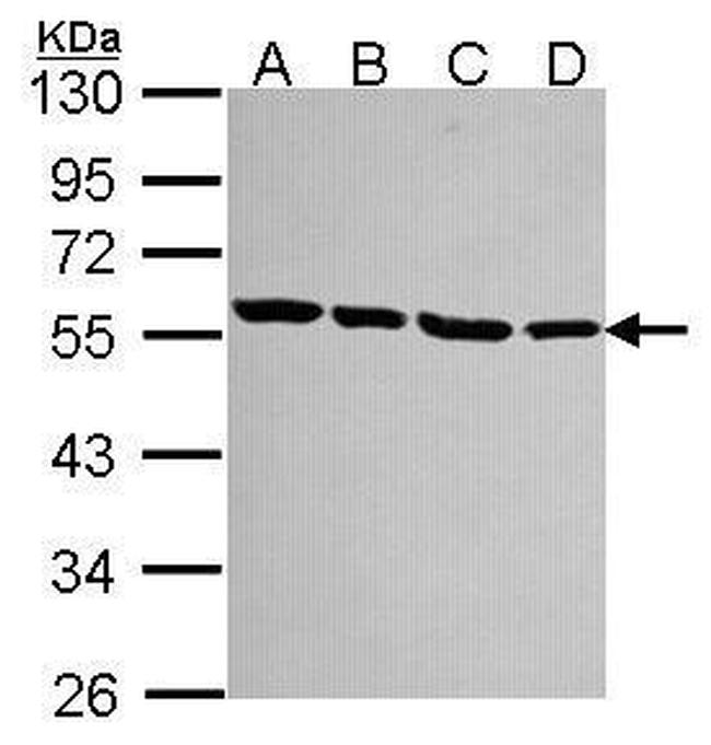 TUBA1A Antibody in Western Blot (WB)