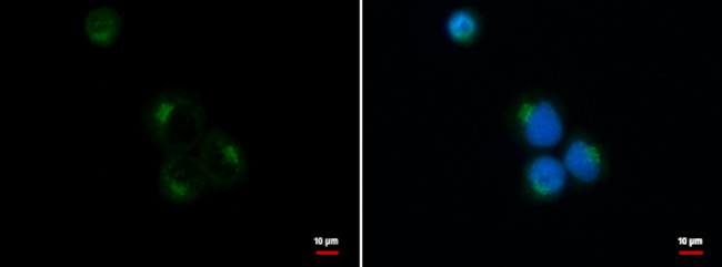 VDP Antibody in Immunocytochemistry (ICC/IF)