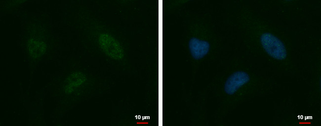 HELIOS Antibody in Immunocytochemistry (ICC/IF)