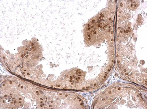 HELIOS Antibody in Immunohistochemistry (Paraffin) (IHC (P))