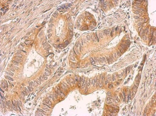 IL-8 (CXCL8) Antibody in Immunohistochemistry (Paraffin) (IHC (P))