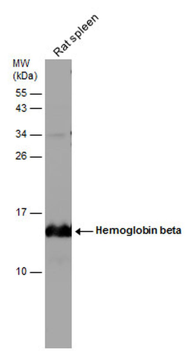 HBB Antibody in Western Blot (WB)