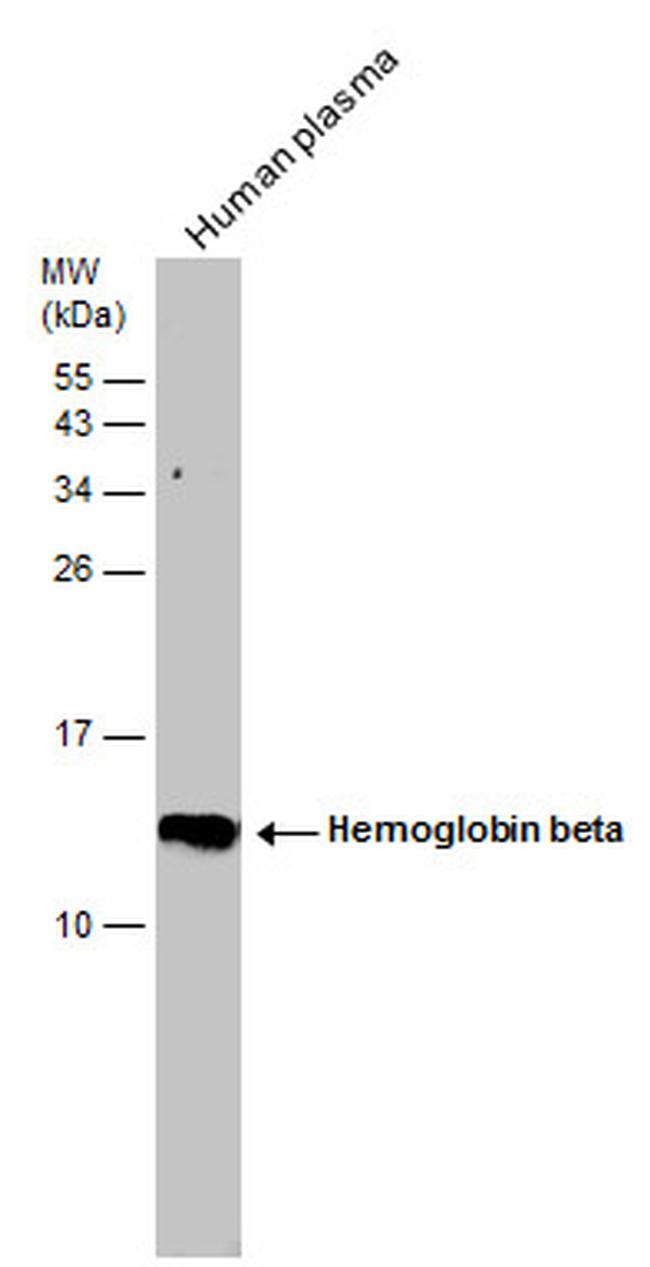 HBB Antibody in Western Blot (WB)