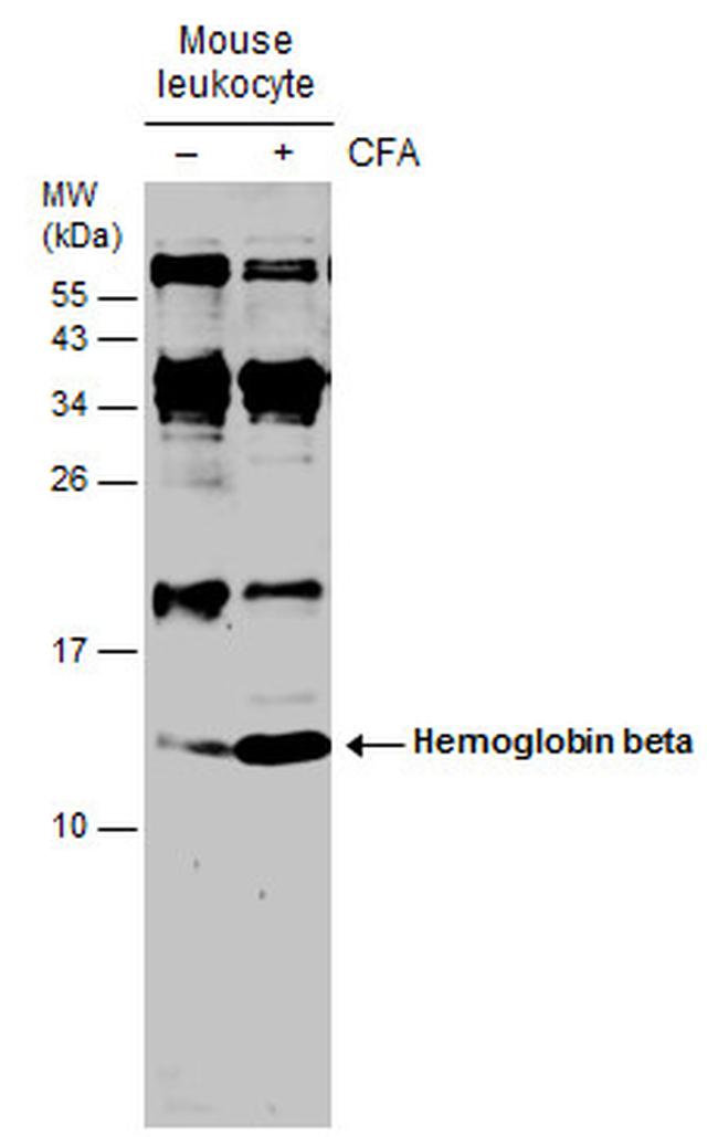 HBB Antibody in Western Blot (WB)