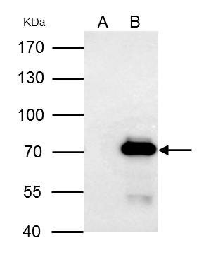 PRMT3 Antibody in Immunoprecipitation (IP)