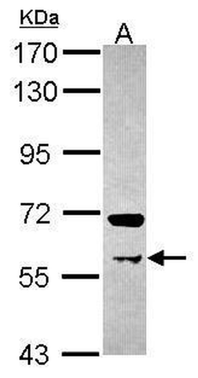 PRMT3 Antibody in Western Blot (WB)