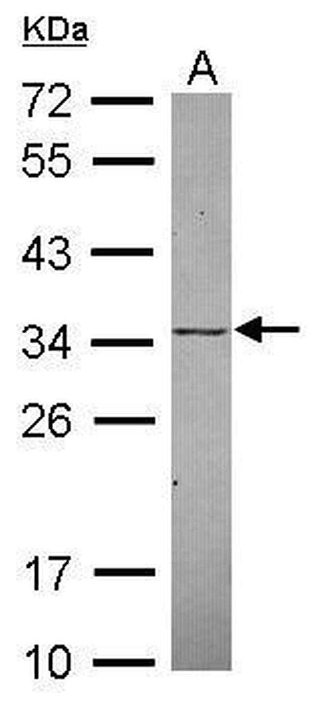 KChIP2 Antibody in Western Blot (WB)