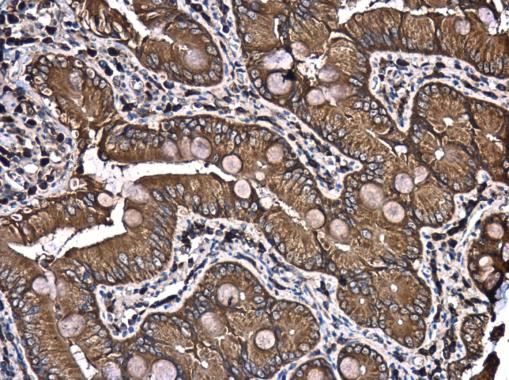 PATJ Antibody in Immunohistochemistry (Paraffin) (IHC (P))