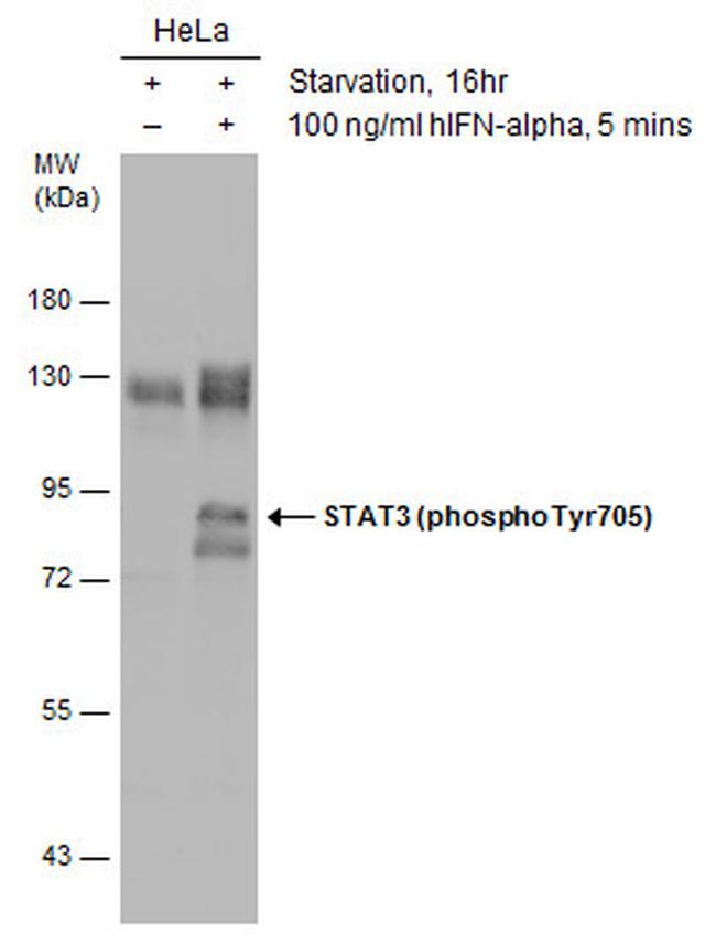Phospho-STAT3 (Tyr705) Antibody in Western Blot (WB)