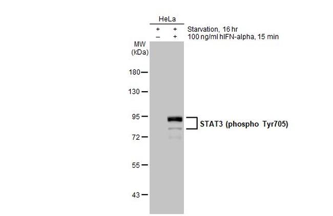 Phospho-STAT3 (Tyr705) Antibody in Western Blot (WB)