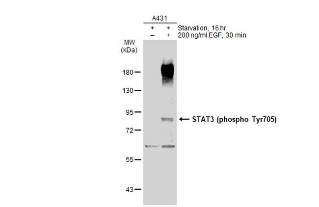 Phospho-STAT3 (Tyr705) Antibody in Western Blot (WB)