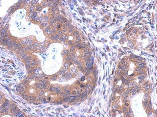 SKA1 Antibody in Immunohistochemistry (Paraffin) (IHC (P))