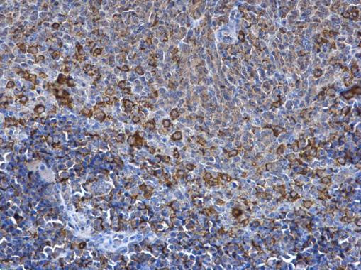 SPATA13 Antibody in Immunohistochemistry (Paraffin) (IHC (P))