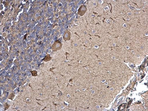 SPATA13 Antibody in Immunohistochemistry (Paraffin) (IHC (P))