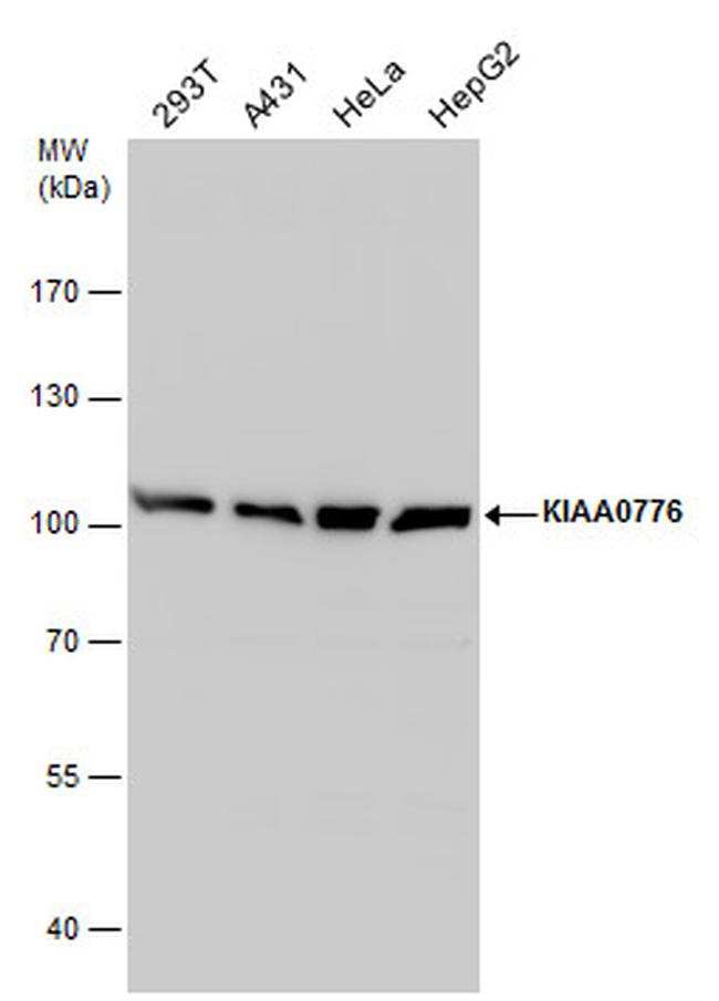 UFL1 Antibody in Western Blot (WB)