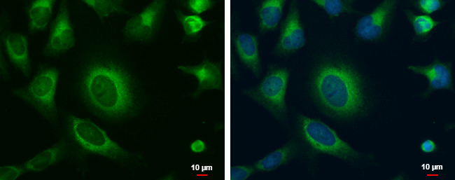 MOSC1 Antibody in Immunocytochemistry (ICC/IF)