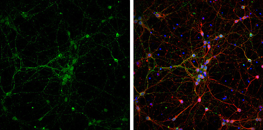 VAMP2 Antibody in Immunocytochemistry (ICC/IF)