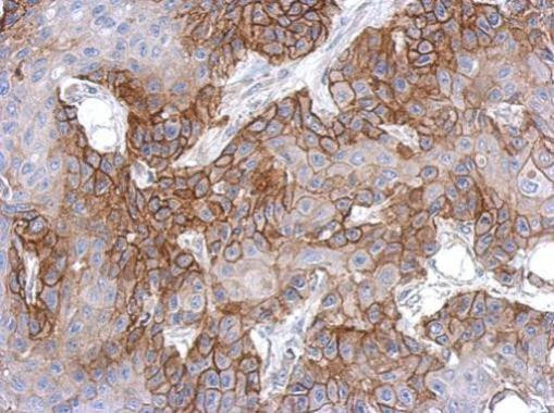 EGFR Antibody in Immunohistochemistry (Paraffin) (IHC (P))