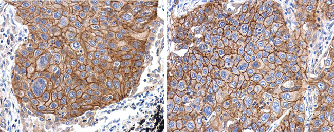 EGFR Antibody in Immunohistochemistry (Paraffin) (IHC (P))