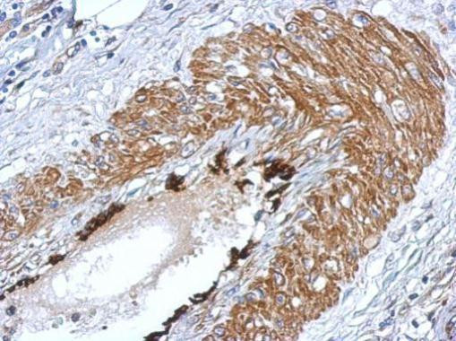 LIN28A Antibody in Immunohistochemistry (Paraffin) (IHC (P))