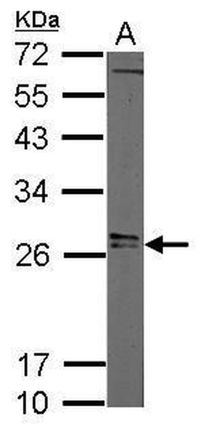 LIN28A Antibody in Western Blot (WB)