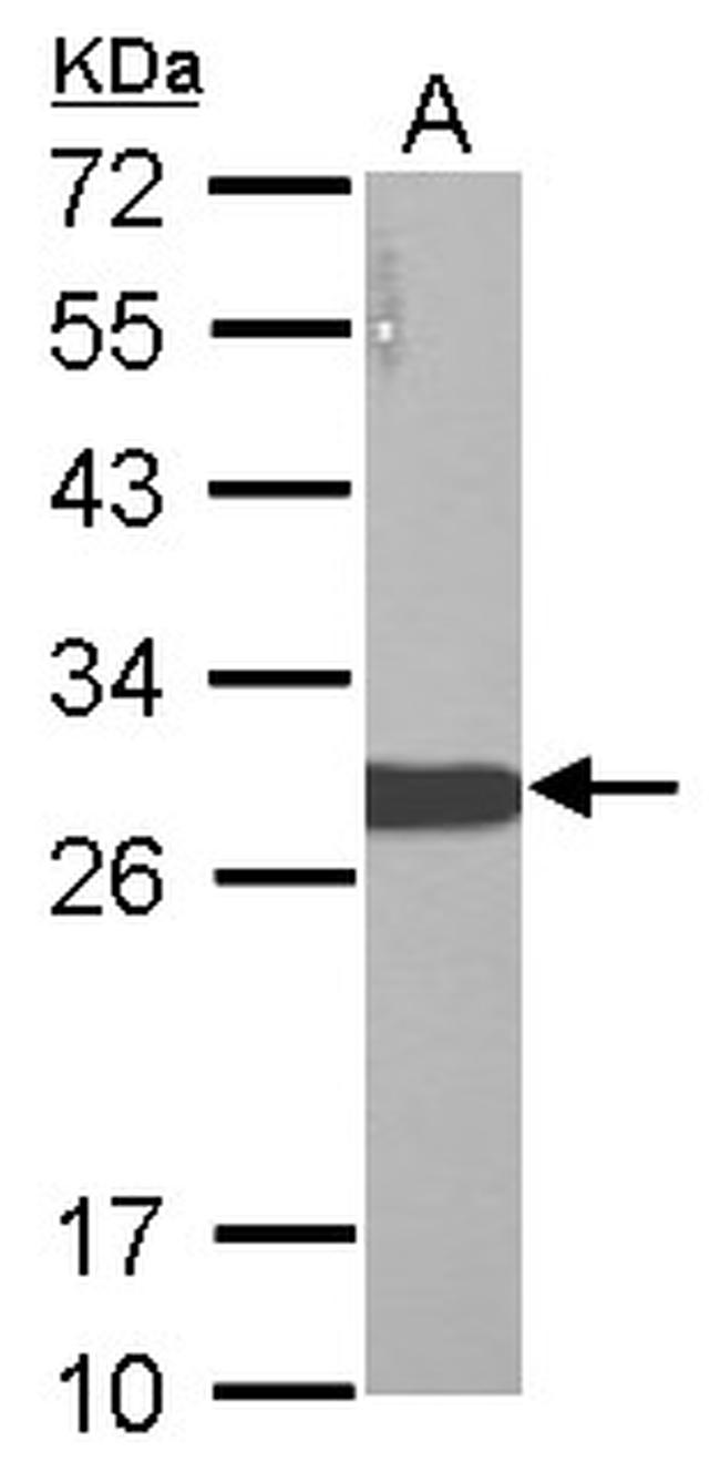 LIN28A Antibody in Western Blot (WB)