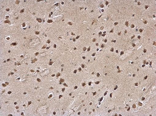 SLUG Antibody in Immunohistochemistry (Paraffin) (IHC (P))