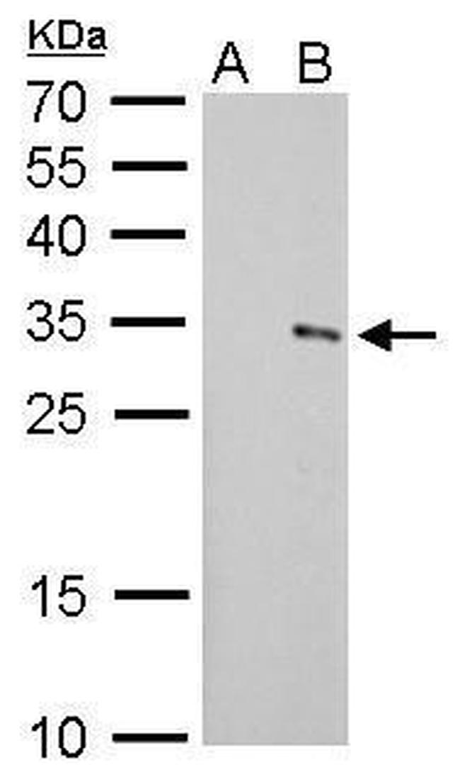 SLUG Antibody in Western Blot (WB)