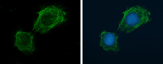 NOX4 Antibody in Immunocytochemistry (ICC/IF)