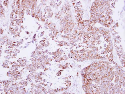 NOX4 Antibody in Immunohistochemistry (Paraffin) (IHC (P))