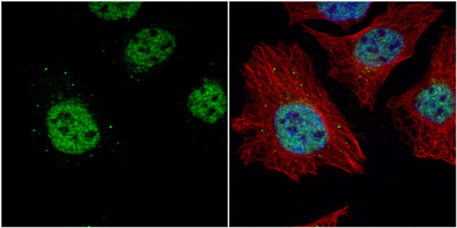 TET2 Antibody in Immunocytochemistry (ICC/IF)