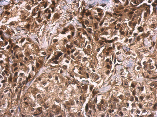 TET2 Antibody in Immunohistochemistry (Paraffin) (IHC (P))