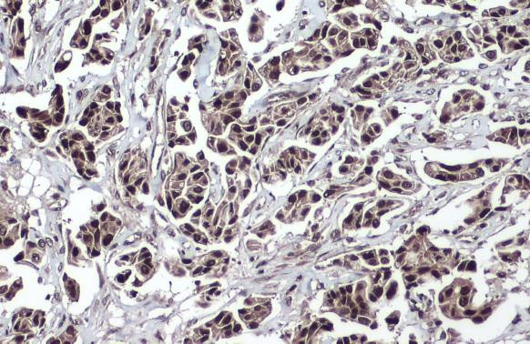 TET2 Antibody in Immunohistochemistry (Paraffin) (IHC (P))