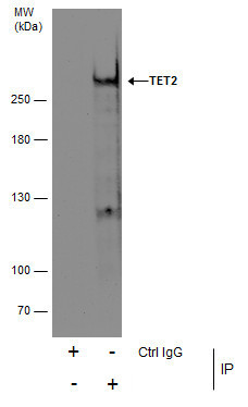 TET2 Antibody in Immunoprecipitation (IP)