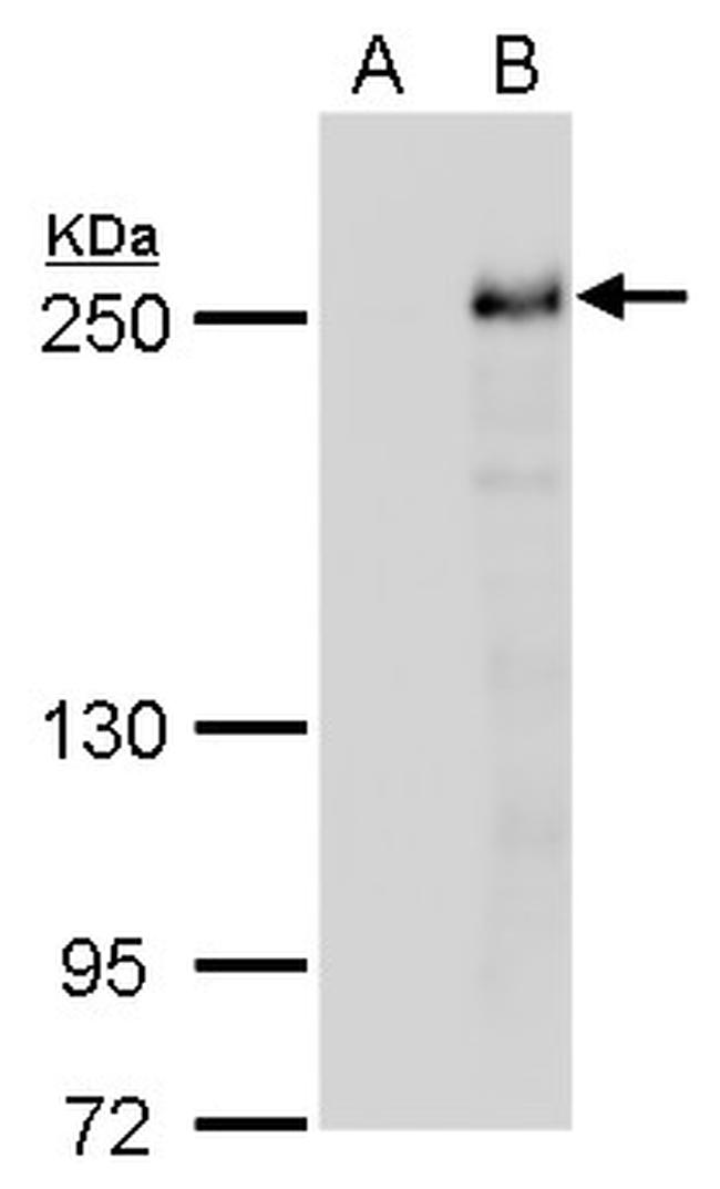 TET2 Antibody in Western Blot (WB)