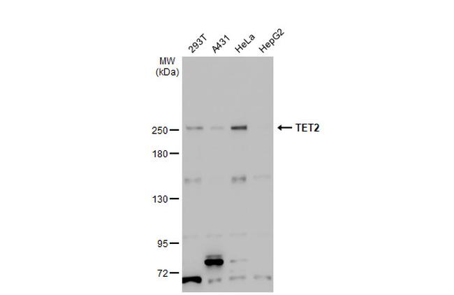 TET2 Antibody in Western Blot (WB)