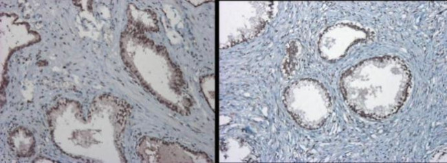 TET1 Antibody in Immunohistochemistry (Paraffin) (IHC (P))