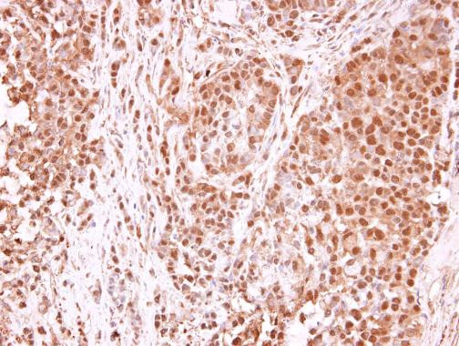 TET1 Antibody in Immunohistochemistry (Paraffin) (IHC (P))