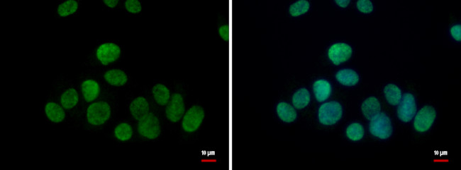 TET1 Antibody in Immunocytochemistry (ICC/IF)