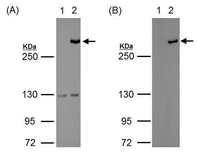 TET1 Antibody in Western Blot (WB)