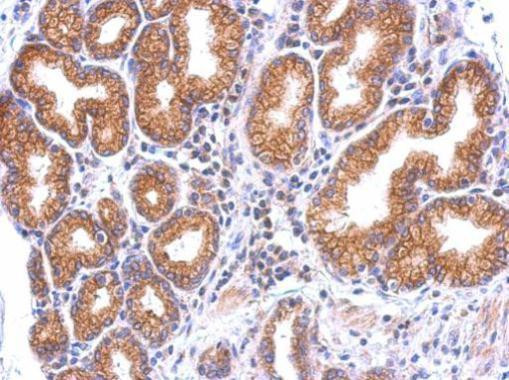 TLR7 Antibody in Immunohistochemistry (Paraffin) (IHC (P))