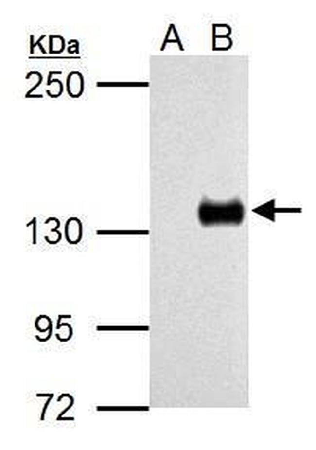 TLR7 Antibody in Western Blot (WB)