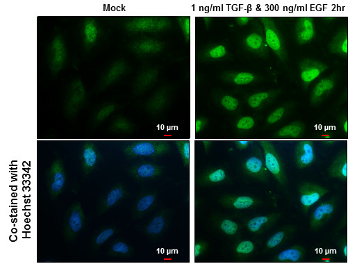 SNAIL Antibody in Immunocytochemistry (ICC/IF)