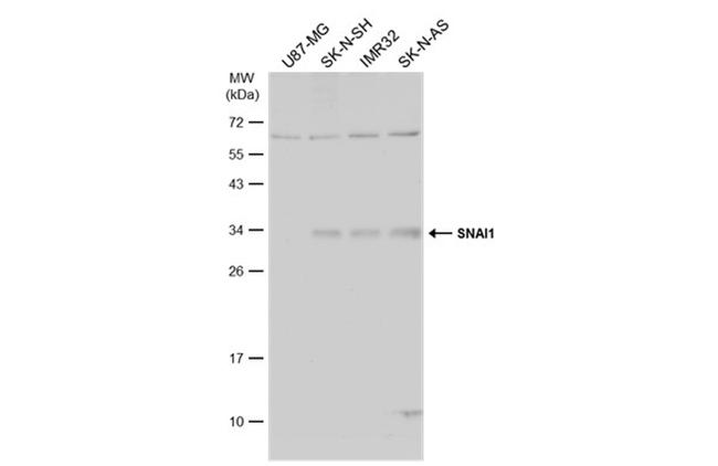 SNAIL Antibody in Western Blot (WB)